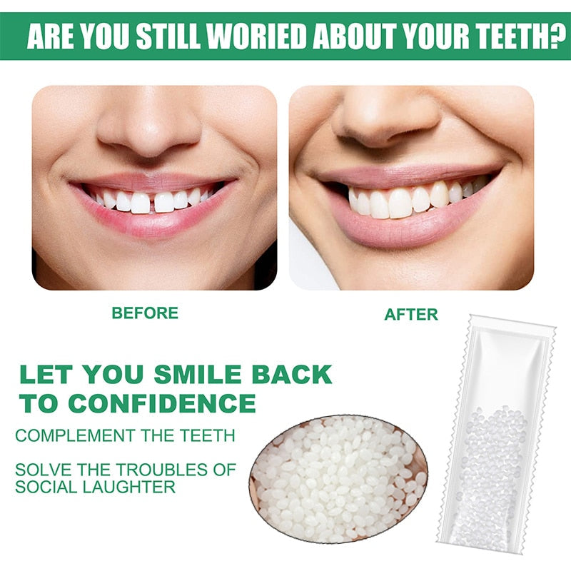 TravelTopp™ Tooth Repair Resin